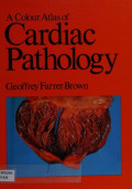 0723407037-cardiac-pathology.jpg.jpg