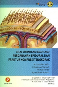 Atlas operasi ilmu bedah saraf : perdarahan epidural dan fraktur kompresi tengkorak