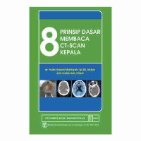 8 Prinsip dasar membaca CT scan