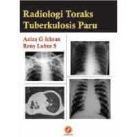 Radiologi toraks tuberkulosis paru